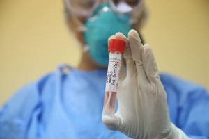 Lee más sobre el artículo Reconquista: informe epidemiológico al 27/03/2020 a las 14 h