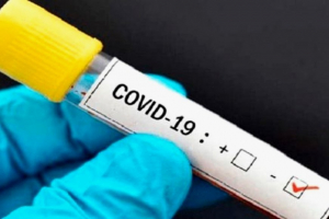 Lee más sobre el artículo Parte oficial Región de Salud al 20 de agosto a las 22 h