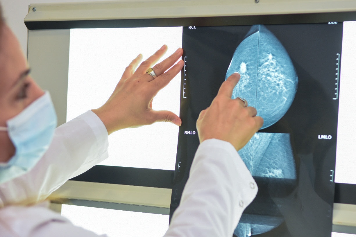 Lee más sobre el artículo Cáncer de Mama: la mamografía es el estudio indicado para su detección temprana