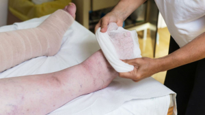 Lee más sobre el artículo 11 de noviembre: Día Nacional del Linfedema