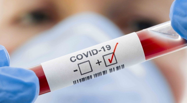 Lee más sobre el artículo Covid-19: Nuevo protocolo para identificación de caso positivo y aislamiento