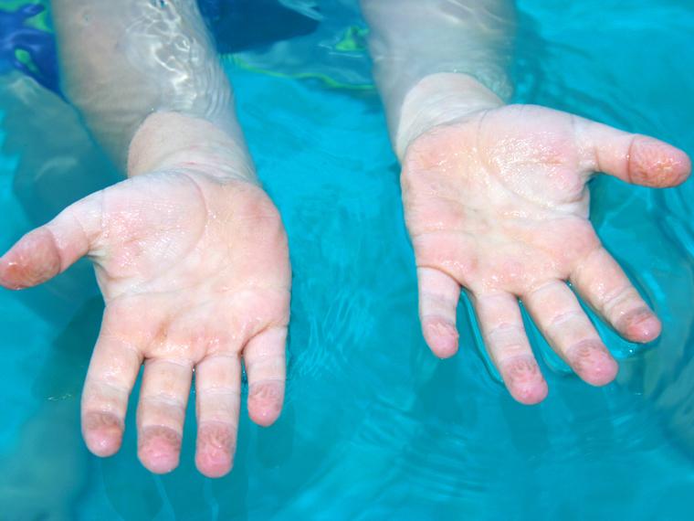 Lee más sobre el artículo Por qué se nos arrugan los dedos cuando nos bañamos