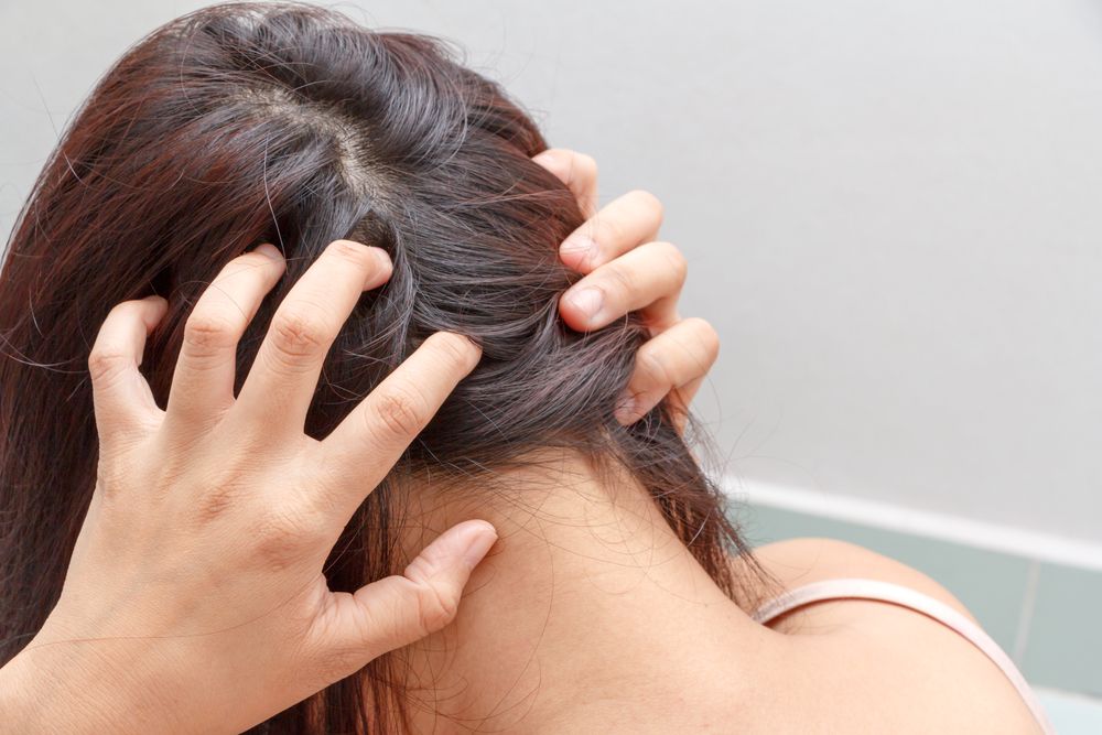 Lee más sobre el artículo ¿Cómo cuidar el cuero cabelludo?
