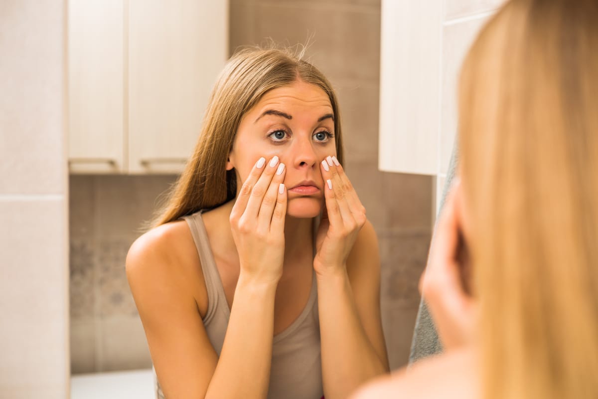 Lee más sobre el artículo Dermatitis del párpado y caspa en las pestañas: la importancia de la higiene ocular