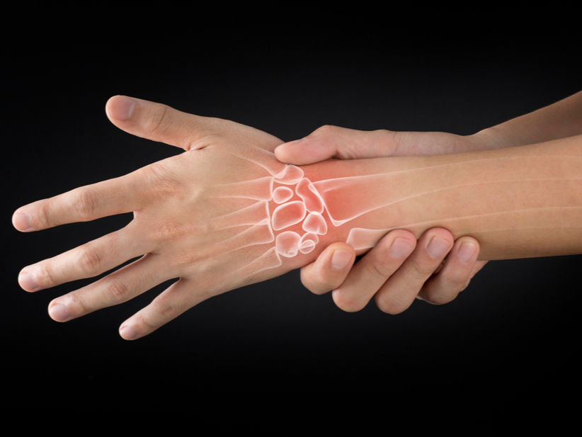 Lee más sobre el artículo Día Mundial de la Artritis Reumatoidea